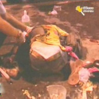 ภาพเหตุการณ์หลังจาก น้องโบว์..ถูกระเบิดแก๊ซน้ำตาที่ชายโครงด้านซ้าย